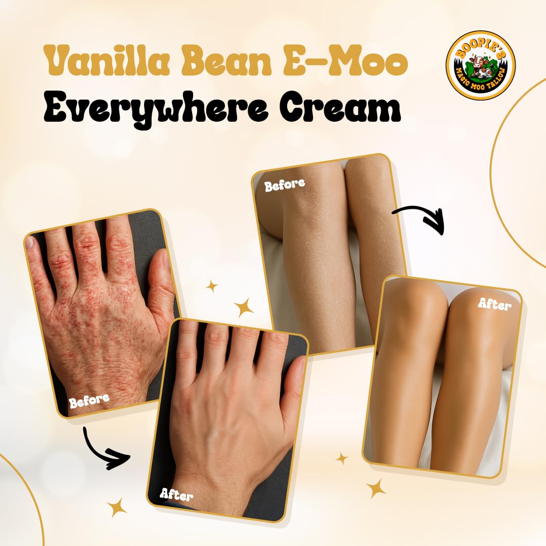 Magic Moo Tallow Vanilla Bean E-Moo Moisturizing Everywhere Cream with Organic Emu Oil. For acne, stretch marks, eczema, hyrdation, dry skin & more.