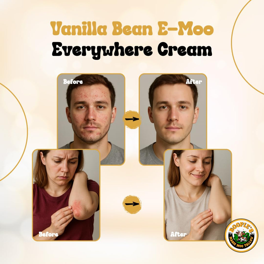 Magic Moo Tallow Vanilla Bean E-Moo Moisturizing Everywhere Cream with Organic Emu Oil. For acne, stretch marks, eczema, hyrdation, dry skin & more.