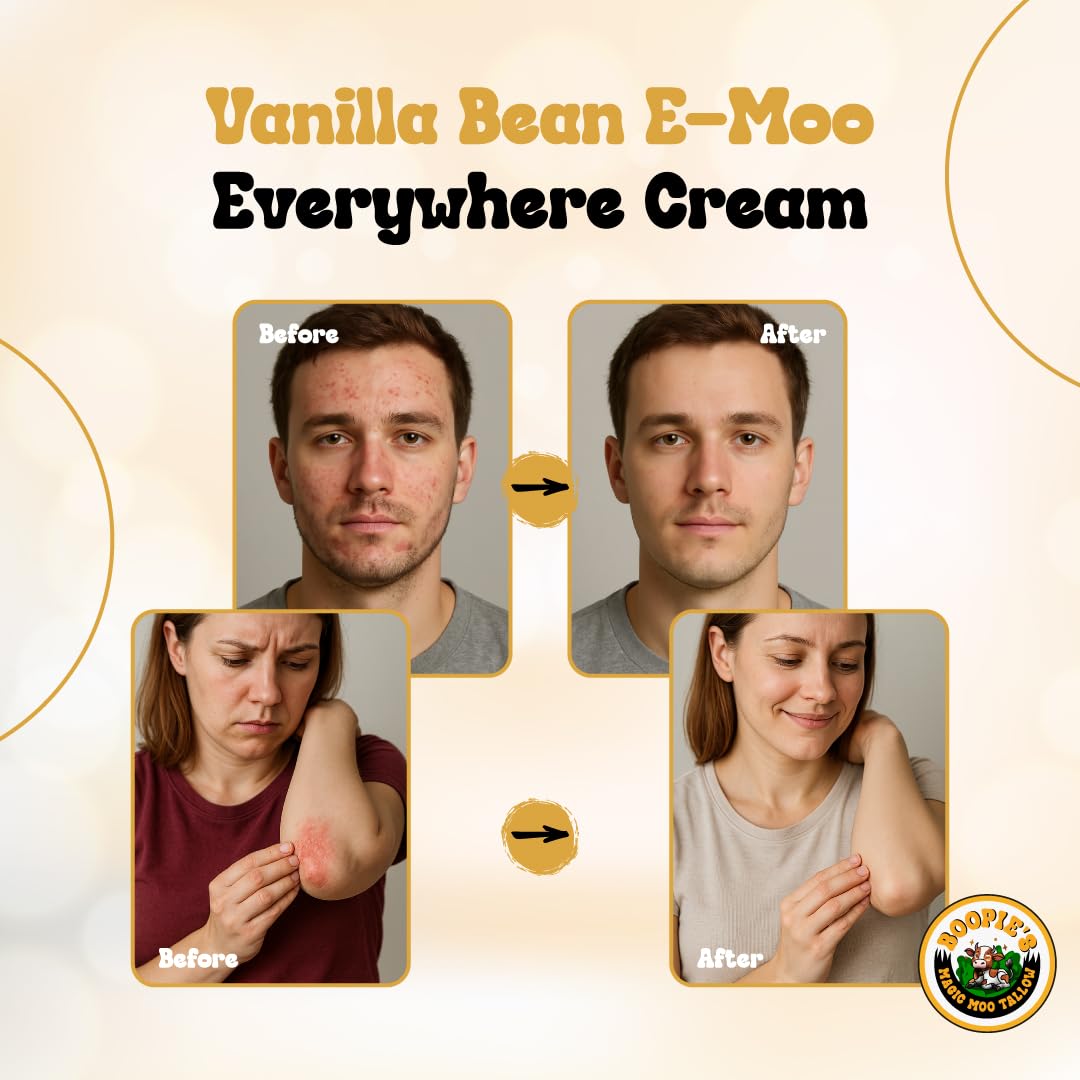 Magic Moo Tallow Vanilla Bean E-Moo Moisturizing Everywhere Cream with Organic Emu Oil. For acne, stretch marks, eczema, hyrdation, dry skin & more.