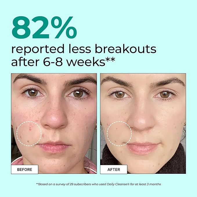 HUM Daily Cleanse Acne Supplements for Women & Men, Gentle Digestive Cleanse for Clear Skin Support, Zinc, Spirulina, Chlorella, Detoxifying Herbs, Organic Algae, Skin Vitamins Supplement, 60 Capsules