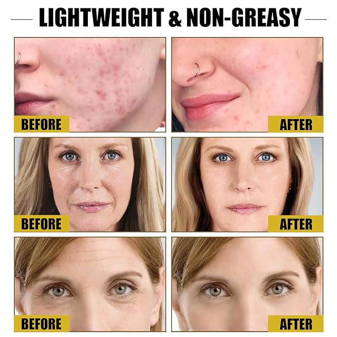 Beauty Elixir Nourishing Body Oil After Shower | Jojoba & Argan Oil | Dry Body Oil for Deep Hydration | Radiant Glow & Smooth Skin | Lightweight Non-greasy With Glutathione (160ml)