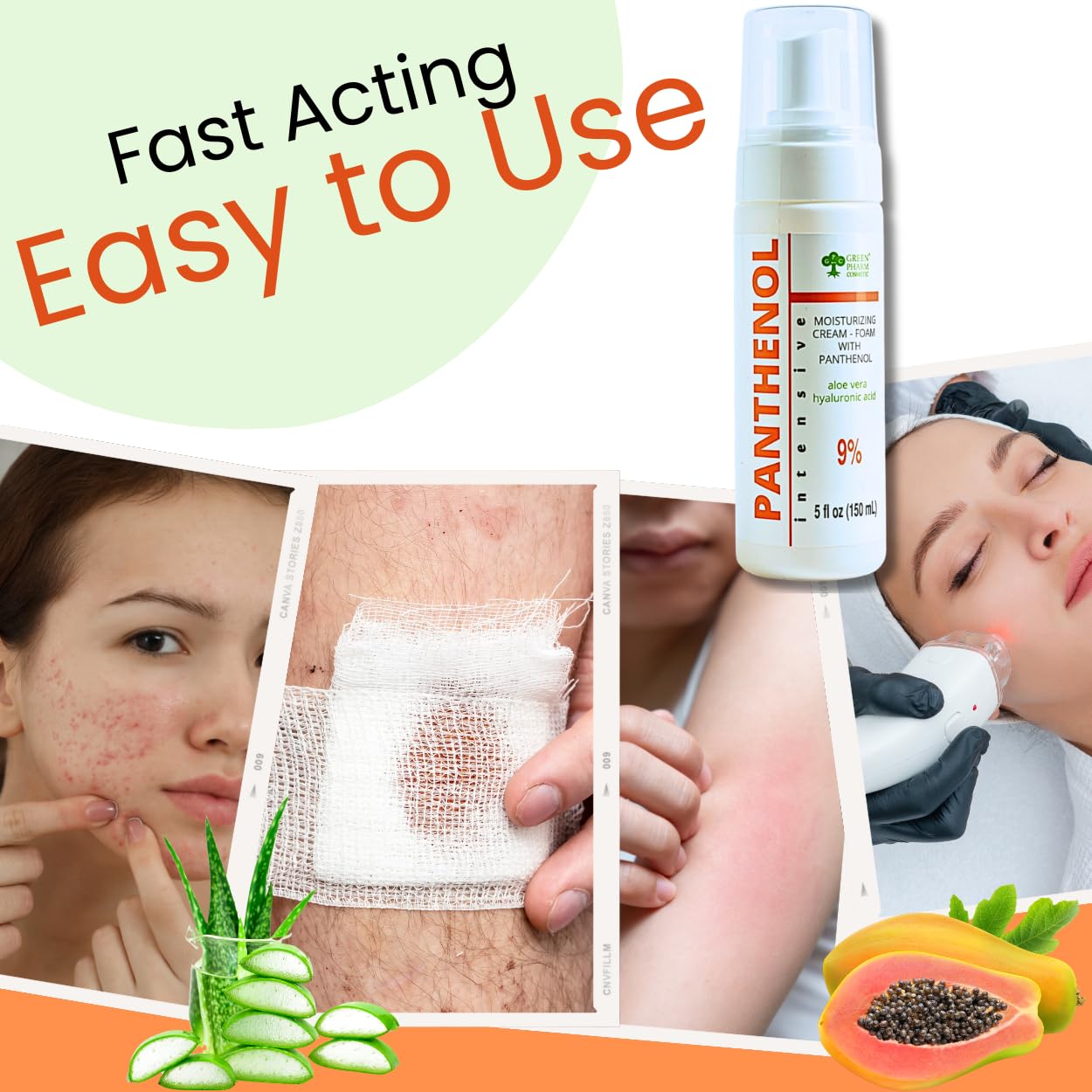 9% Panthenol Foam Spray, Vitamin B5 + Deep Moisturizing Hyaluronic Acid After Sun Care, After Tattoo Care, Hair Transplant & Baby Rash Relief, 3.4 Oz / 100 ml (Foam, 150 Ml)