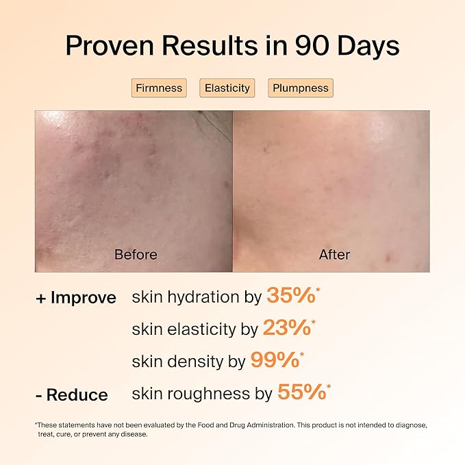 Ownist Triple Collagen Liquid Packets On-The-Go - Peptides with Hydrolyzed Marine Collagen, Elastin, Hyaluronic Acid and Vitamin for Healthy Skin - Orange Flavor - 14 Individual Stick Packs