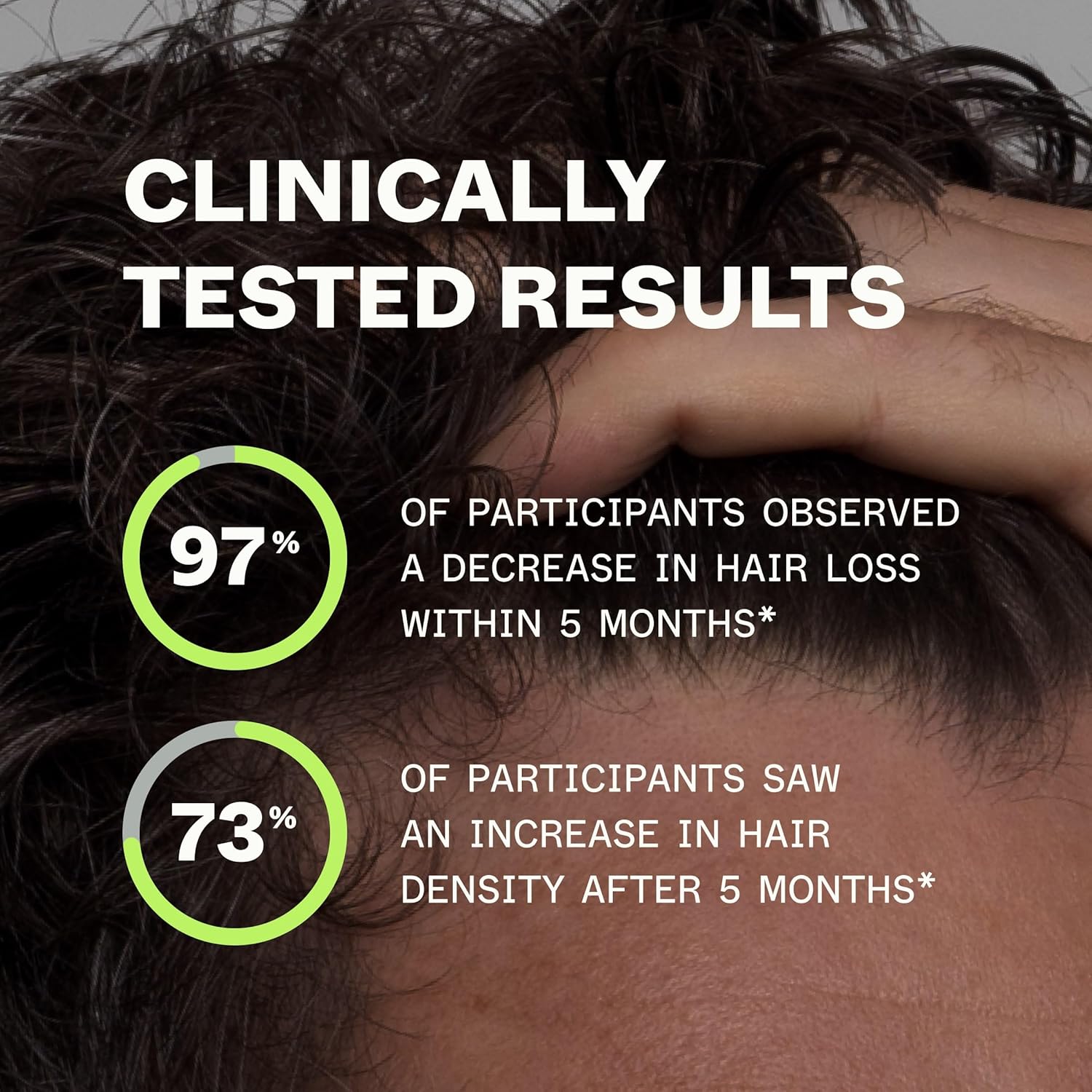 Scandinavian Biolabs Bio-Pilixin® Serum For Men | Helps Reduce Hair Loss Due to Breakage, Help Activate Hair Growth, Stem Cell Technology, Drug-Free Daily Use, Clinically Tested, 100 mL/ 3.4 Oz