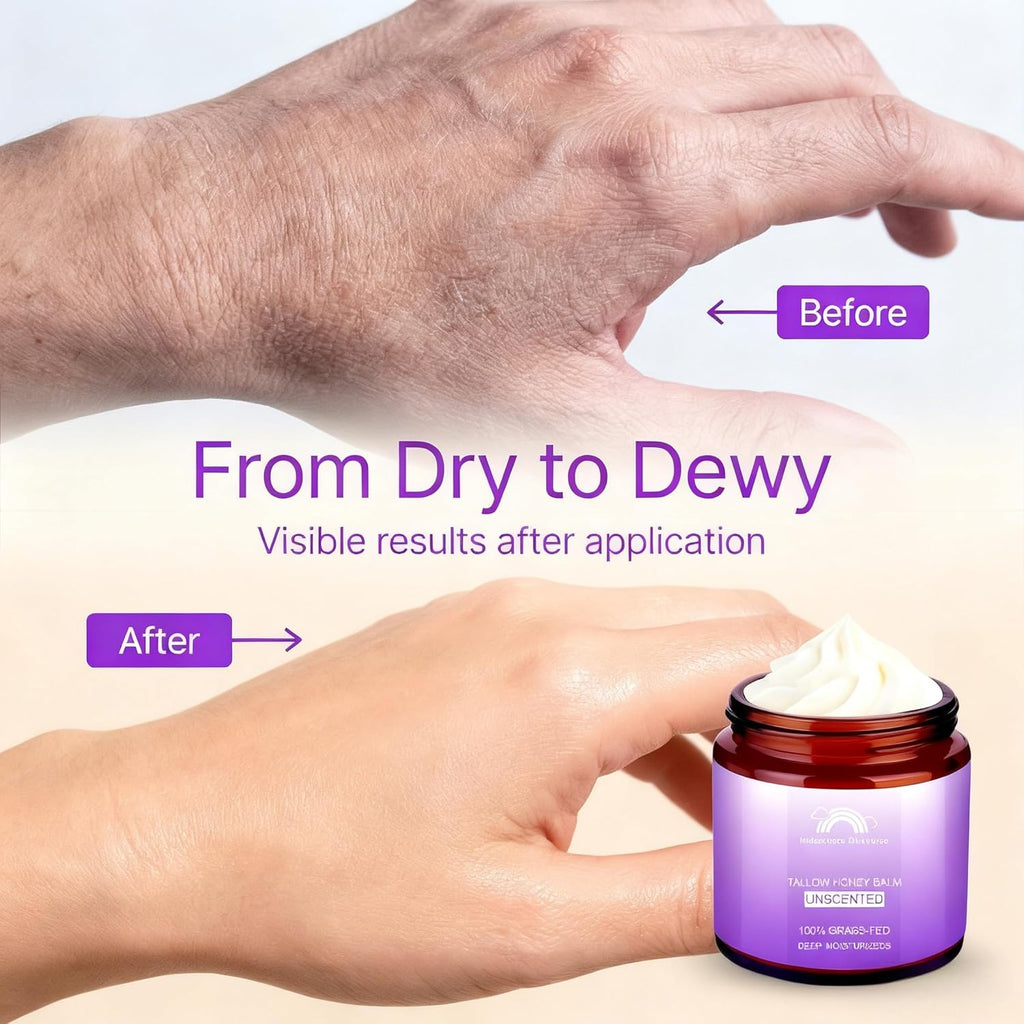 Beef Tallow for Skin, Grass-Fed Tallow and Honey Balm, Nourishing Tallow Face Moisturizer – Natural Beef Tallow for Dry, Sensitive, or Irritated Skin–Unscented–4oz