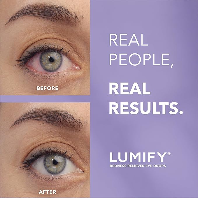 LUMIFY Eye Drops for Red Eyes, Redness Reliever for Brighter Looking Eyes, Works in 1 Minute & Lasts Up to 8 Hours, Eye Drops, 0.25 Fl Oz (7.5mL)