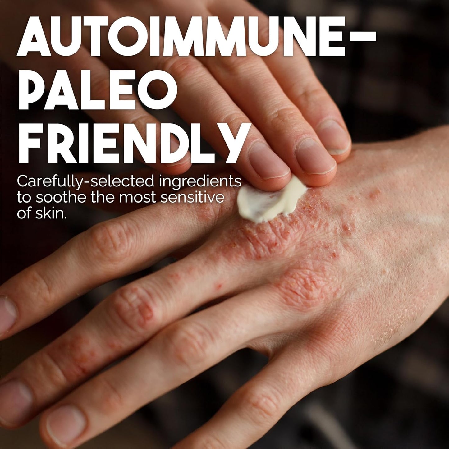 BALM OF GILEAD Manuka Eczema Honey Cream - Moisturizer for Sensitive Skin, Eczema, Psoriasis & Dermatitis - Manuka Honey Ointment, Grassfed Tallow